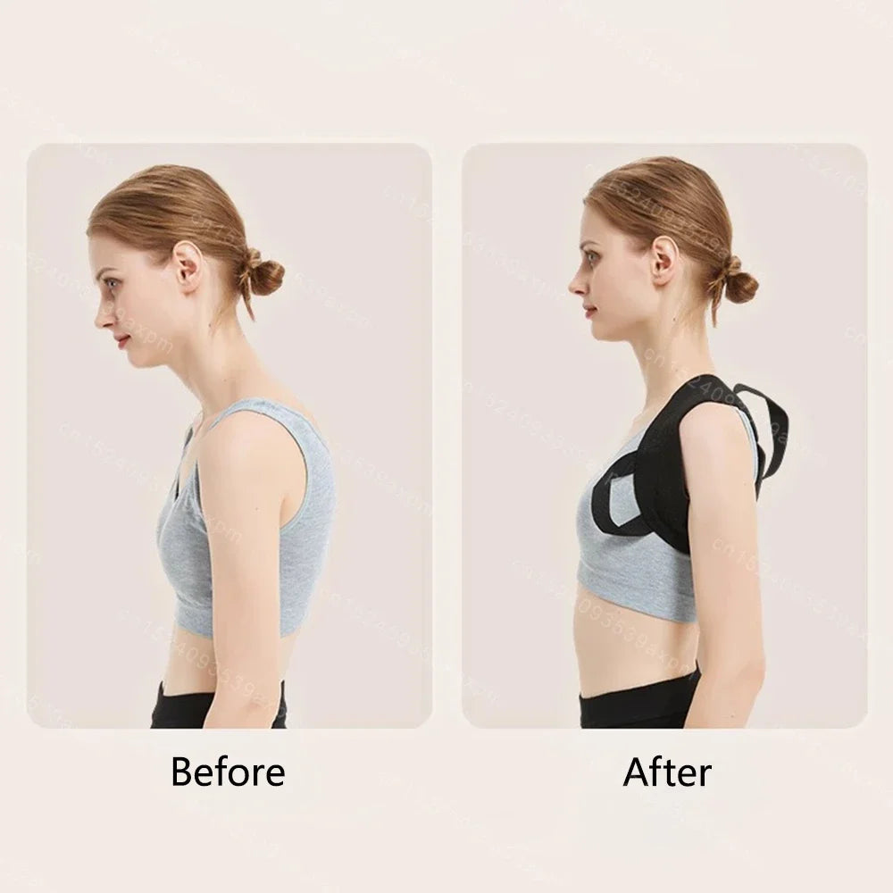 Back Posture Corrector Clavicle Spine Back Brace